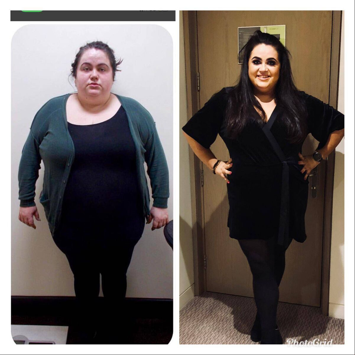 BEFORE AND AFTER: Trisha feels so much better having shed the weight. BEFORE AND AFTER: Trisha feels so much better having shed the weight.